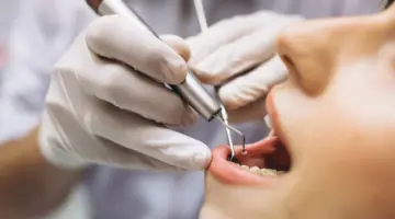 “وزارتا الموارد البشرية والصحة”.. يعلنا بدء تنفيذ توطين مهنة طب الأسنان